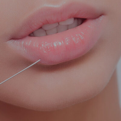 A woman’s lip is being injected with a needle by an Anchorage orthodontist.