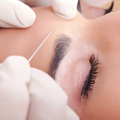 A woman getting her eyebrows injected with a needle for cosmetic enhancements.